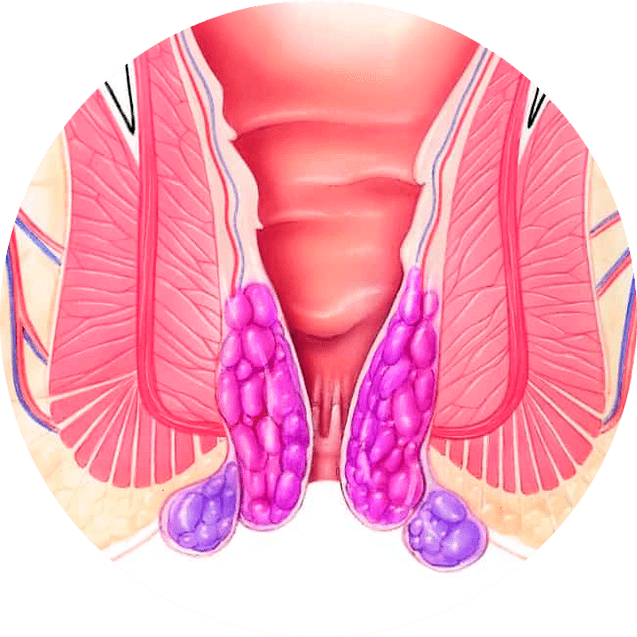 Gelarex ublažava simptome već pri prvoj uporabi